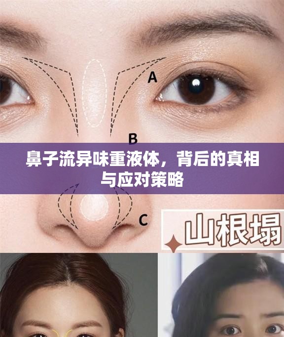 鼻子流異味重液體，背后的真相與應(yīng)對策略