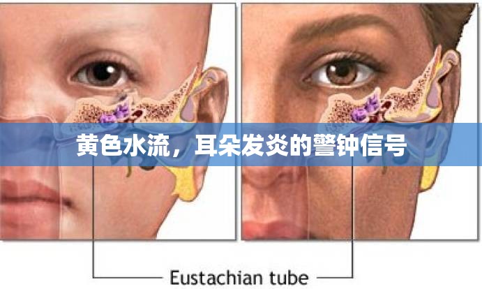 黃色水流，耳朵發(fā)炎的警鐘信號