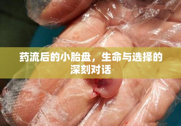 藥流后的小胎盤，生命與選擇的深刻對話