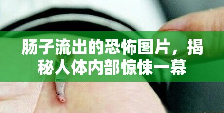 腸子流出的恐怖圖片，揭秘人體內(nèi)部驚悚一幕