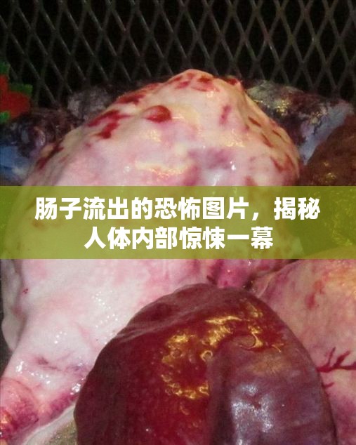腸子流出的恐怖圖片，揭秘人體內(nèi)部驚悚一幕