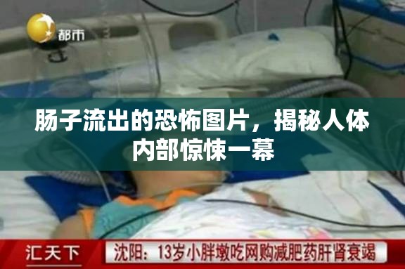 腸子流出的恐怖圖片，揭秘人體內(nèi)部驚悚一幕