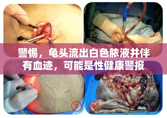 警惕，龜頭流出白色膿液并伴有血跡，可能是性健康警報(bào)