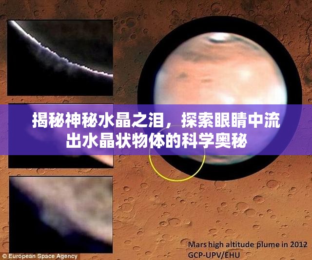 揭秘神秘水晶之淚，探索眼睛中流出水晶狀物體的科學(xué)奧秘