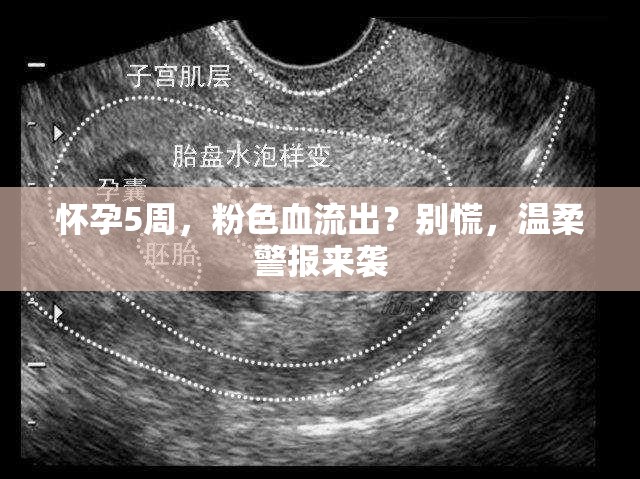 懷孕5周，粉色血流出？別慌，溫柔警報來襲