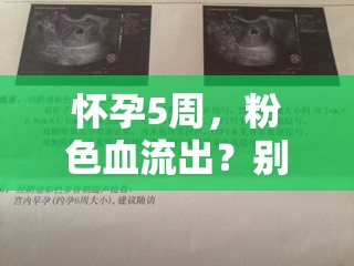 懷孕5周，粉色血流出？別慌，溫柔警報來襲