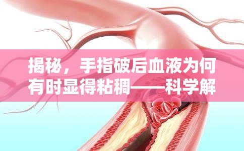 揭秘，手指破后血液為何有時顯得粘稠——科學解析血液凝固與粘度