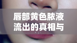 唇部黃色膿液流出的真相與應(yīng)對策略