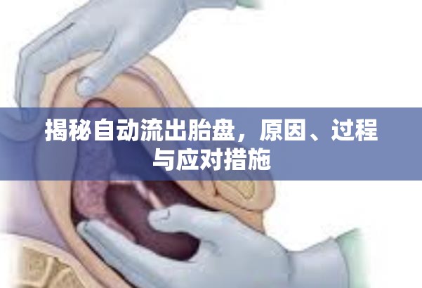 揭秘自動(dòng)流出胎盤，原因、過程與應(yīng)對(duì)措施