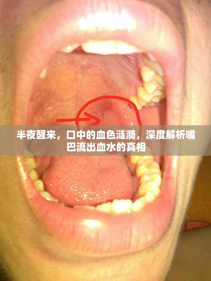 半夜醒來，口中的血色漣漪，深度解析嘴巴流出血水的真相