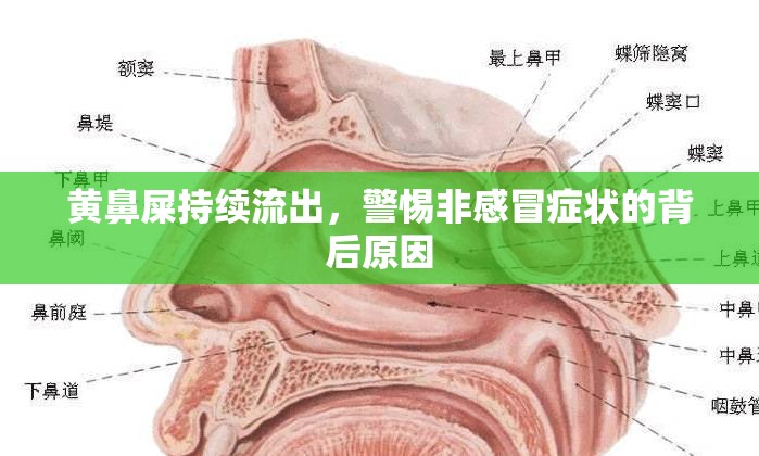 黃鼻屎持續(xù)流出，警惕非感冒癥狀的背后原因