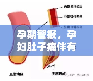 孕期警報，孕婦肚子痛伴有褐色血流出的真相與應(yīng)對策略