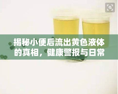 揭秘小便后流出黃色液體的真相，健康警報(bào)與日常護(hù)理指南