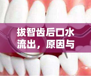 拔智齒后口水流出，原因與應(yīng)對(duì)方法
