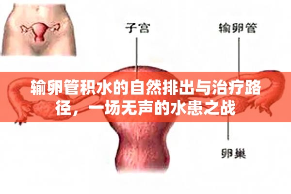 輸卵管積水的自然排出與治療路徑，一場(chǎng)無(wú)聲的水患之戰(zhàn)