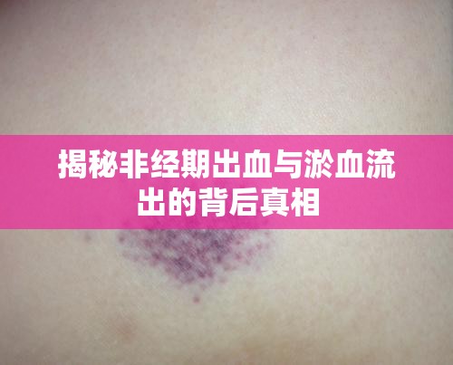 揭秘非經(jīng)期出血與淤血流出的背后真相