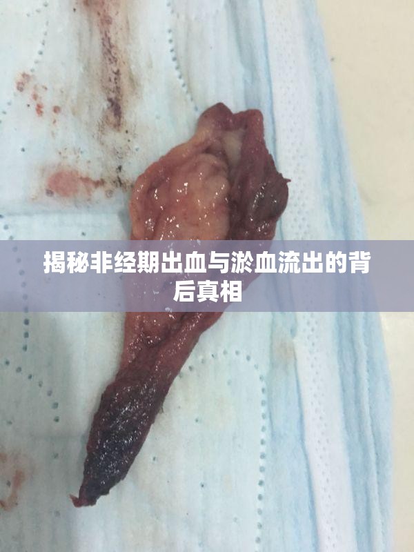 揭秘非經(jīng)期出血與淤血流出的背后真相