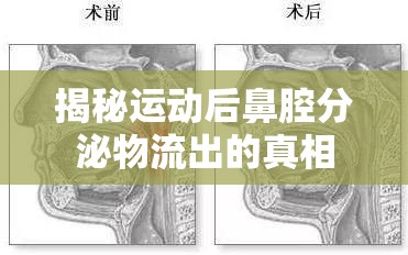 揭秘運(yùn)動(dòng)后鼻腔分泌物流出的真相