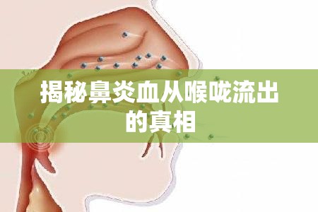 揭秘鼻炎血從喉嚨流出的真相
