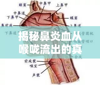 揭秘鼻炎血從喉嚨流出的真相