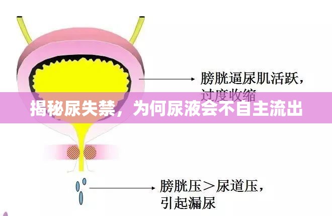 揭秘尿失禁，為何尿液會(huì)不自主流出