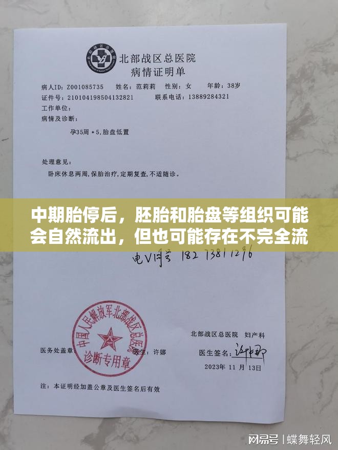 中期胎停后，胚胎和胎盤等組織可能會自然流出，但也可能存在不完全流產(chǎn)的情況，即部分組織殘留在子宮內(nèi)。因此，即使有自然流出的現(xiàn)象，仍需進行醫(yī)學(xué)檢查和必要的手術(shù)操作以確保完全流產(chǎn)和子宮健康。