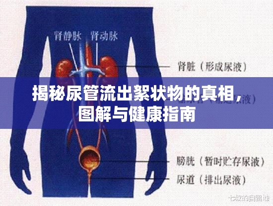 揭秘尿管流出絮狀物的真相，圖解與健康指南