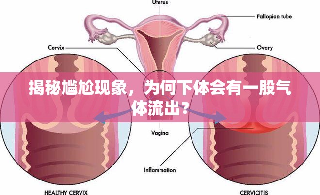 揭秘尷尬現(xiàn)象，為何下體會(huì)有一股氣體流出？