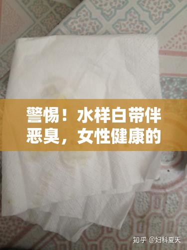 警惕！水樣白帶伴惡臭，女性健康的隱形危機(jī)