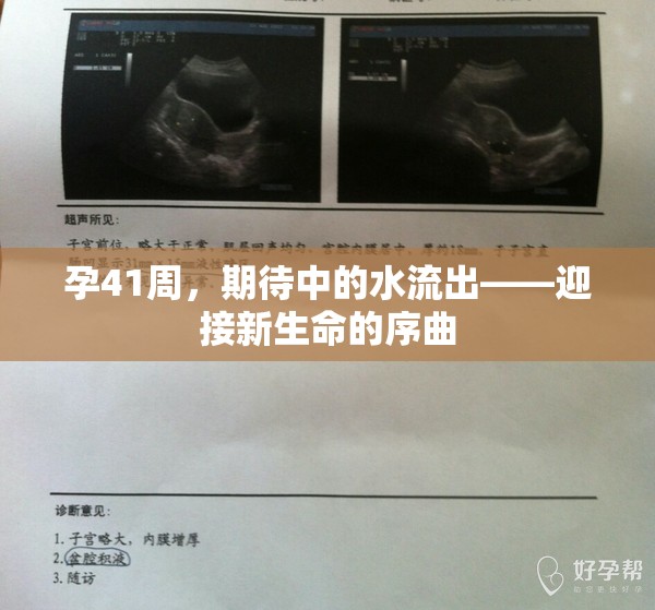 孕41周，期待中的水流出——迎接新生命的序曲