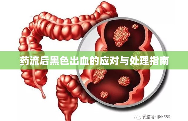 藥流后黑色出血的應(yīng)對與處理指南