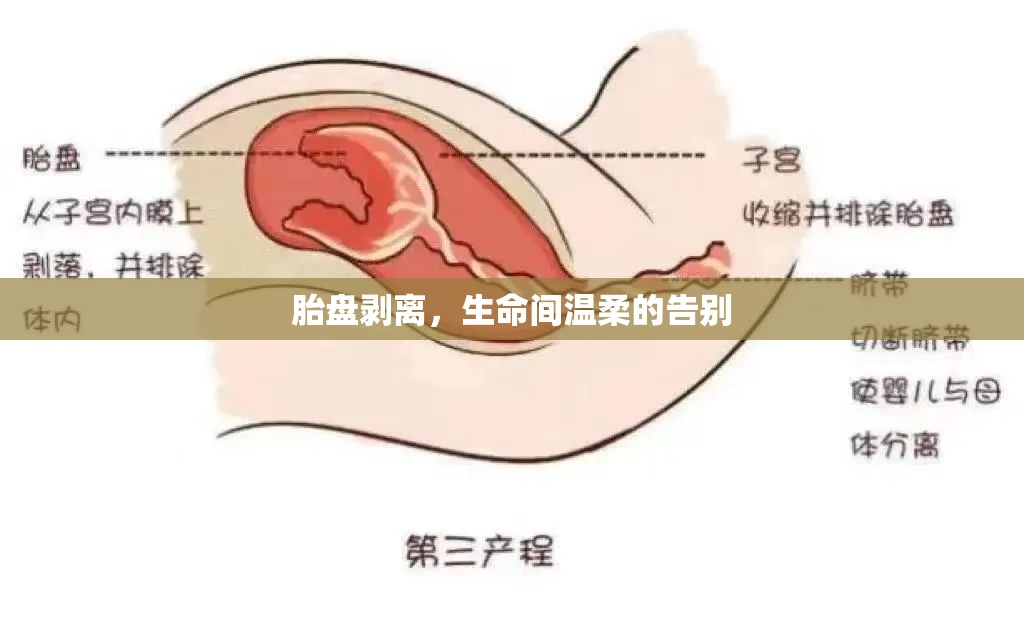 胎盤剝離，生命間溫柔的告別