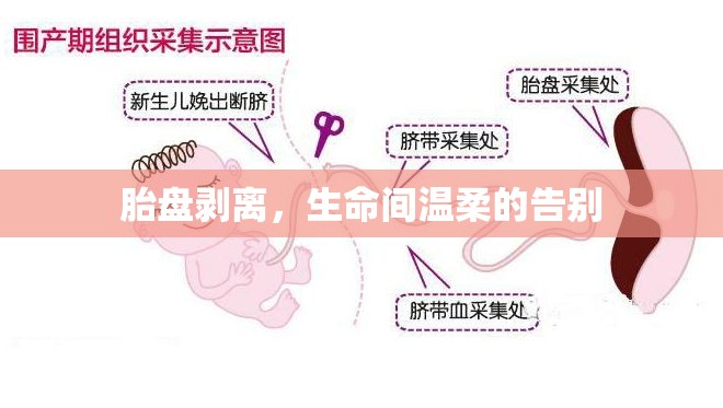 胎盤剝離，生命間溫柔的告別