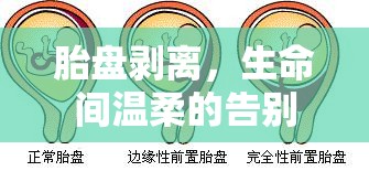 胎盤剝離，生命間溫柔的告別