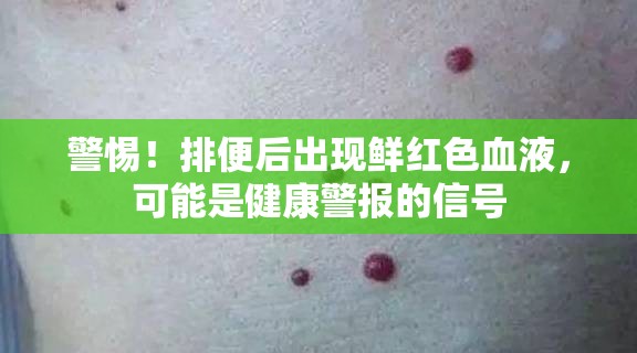 警惕！排便后出現(xiàn)鮮紅色血液，可能是健康警報的信號