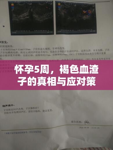 懷孕5周，褐色血渣子的真相與應(yīng)對策略