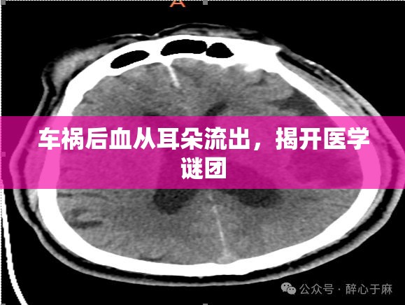 車禍后血從耳朵流出，揭開(kāi)醫(yī)學(xué)謎團(tuán)