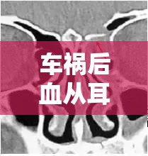 車禍后血從耳朵流出，揭開(kāi)醫(yī)學(xué)謎團(tuán)