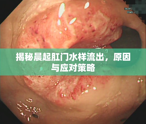 揭秘晨起肛門水樣流出，原因與應(yīng)對(duì)策略