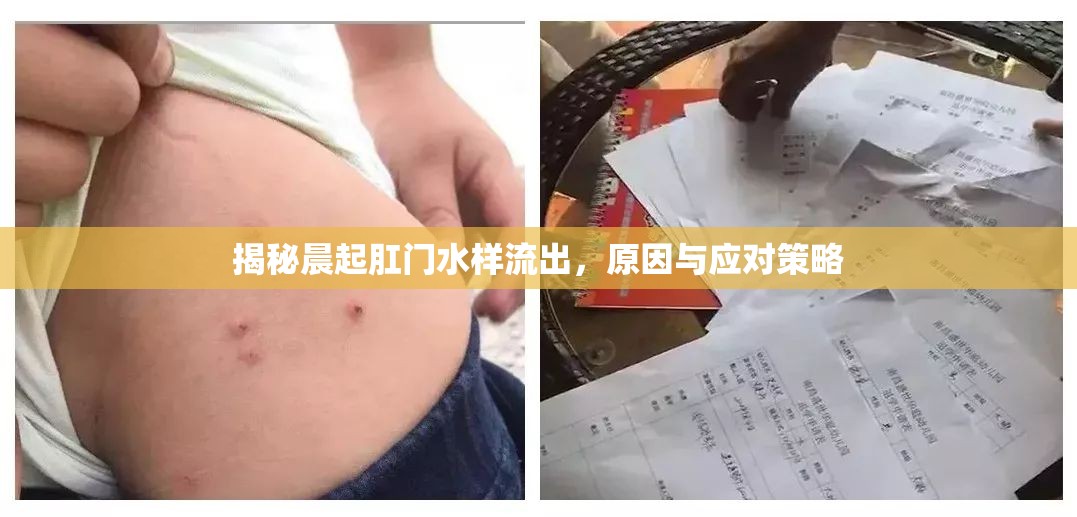 揭秘晨起肛門水樣流出，原因與應(yīng)對(duì)策略