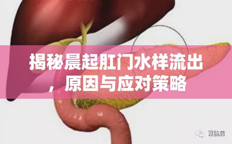 揭秘晨起肛門水樣流出，原因與應(yīng)對(duì)策略