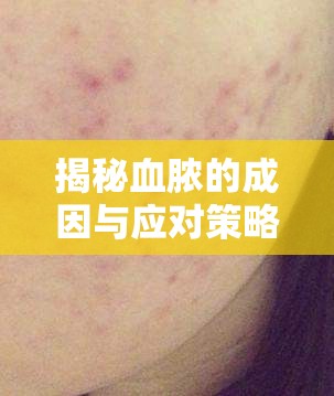 揭秘血膿的成因與應(yīng)對策略，膿包之謎
