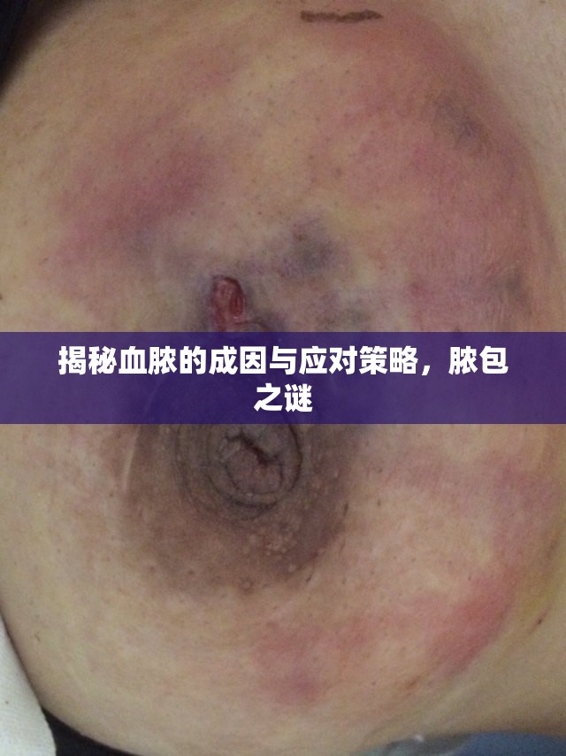 揭秘血膿的成因與應(yīng)對策略，膿包之謎