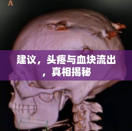 建議，頭疼與血塊流出，真相揭秘