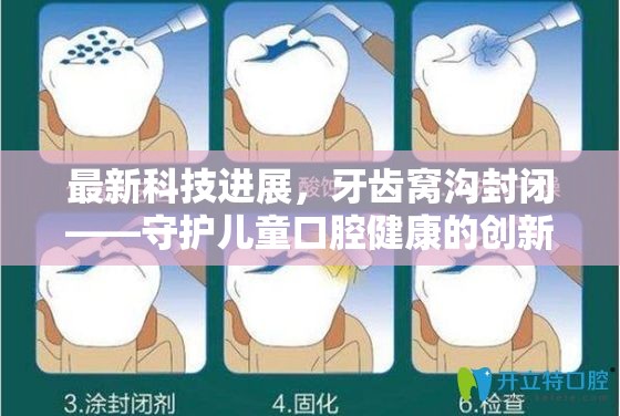最新科技進(jìn)展，牙齒窩溝封閉——守護(hù)兒童口腔健康的創(chuàng)新之選