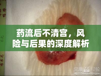 藥流后不清宮，風險與后果的深度解析
