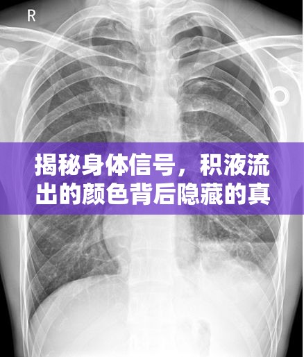 揭秘身體信號，積液流出的顏色背后隱藏的真相
