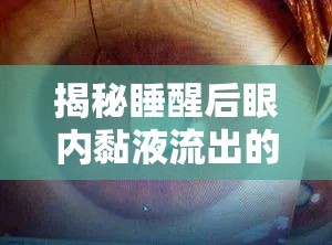 揭秘睡醒后眼內(nèi)黏液流出的健康信號(hào)