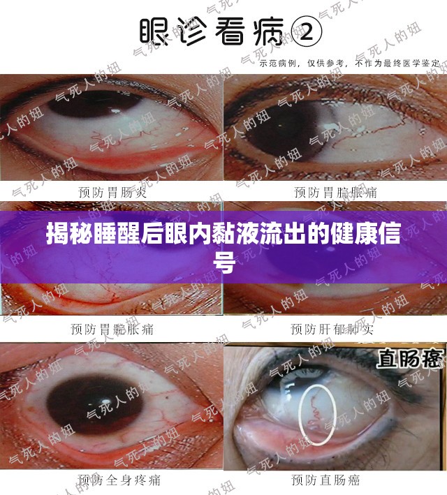 揭秘睡醒后眼內(nèi)黏液流出的健康信號(hào)