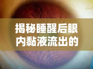 揭秘睡醒后眼內(nèi)黏液流出的健康信號(hào)